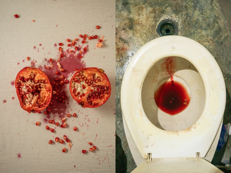 © Andrea Hernández Briceño - Image from the Hold my Hand photography project