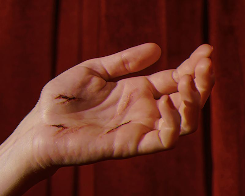 © Anna Tihanyi - Homemaker - Scars on hand