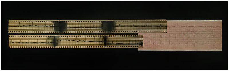© Anna Tihanyi - Heartbeats - My grandmother's ECG handsewn together with my ECG (taken by my mother who is a general practicioner)
