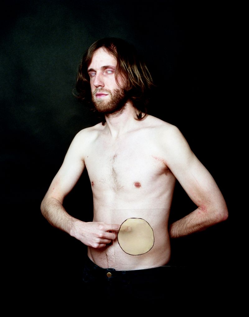 © Søren Lilholt - Untitled (do ist mir weh)