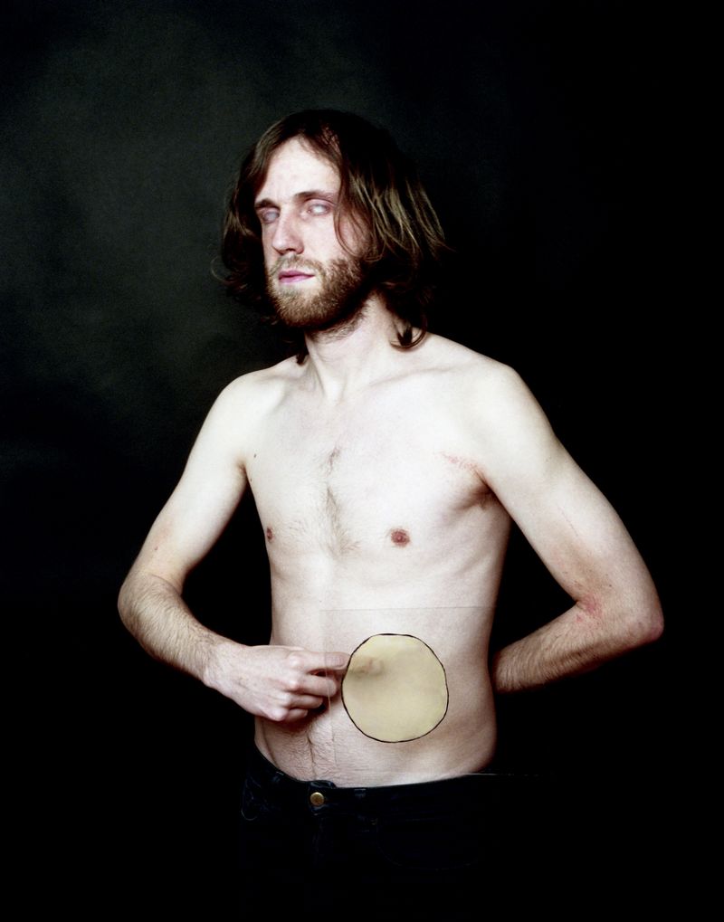 © Søren Lilholt - Untitled (do ist mir weh)