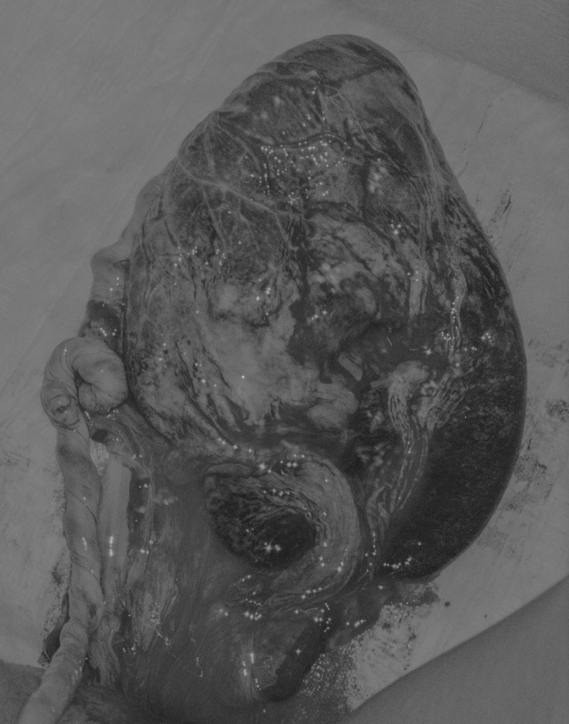 © Johanna Berghorn - Placenta, where life takes route.