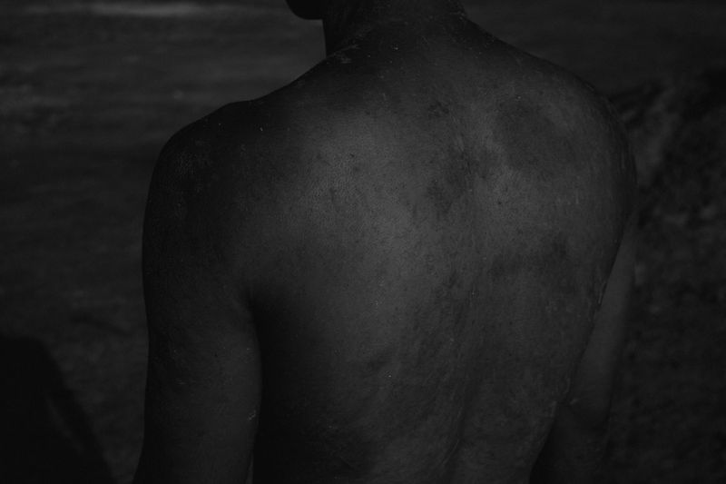 © Chen Chuanduan - Chen Chuanduan, Scars of Captivity, from the series Everett’s Notes, 2024