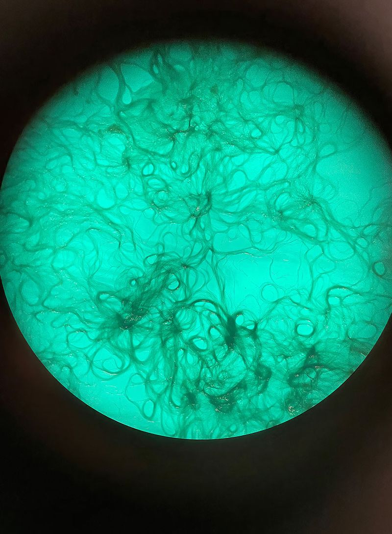 © Alice Pallot - Algues maudites, a sea of tears, microscopic view, 2022