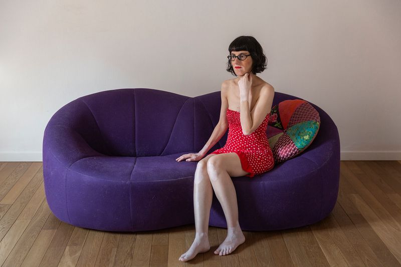 © Rosa Mariniello - Image from the VITILIGO photography project