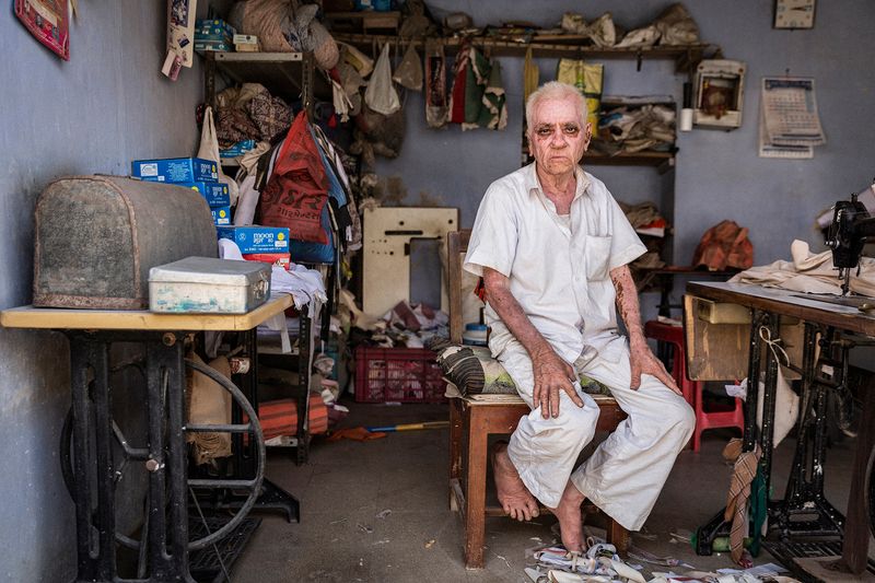 © Rosa Mariniello - Image from the VITILIGO photography project