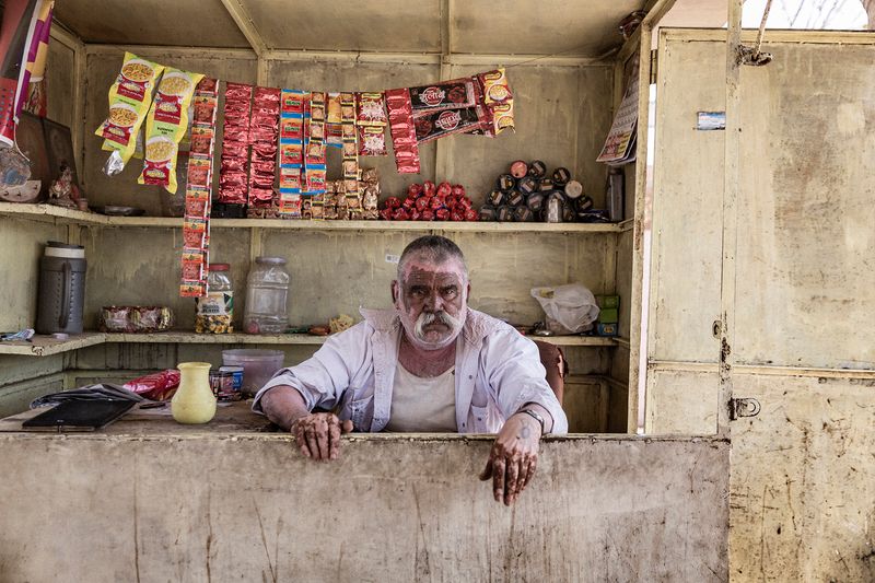© Rosa Mariniello - Image from the VITILIGO photography project