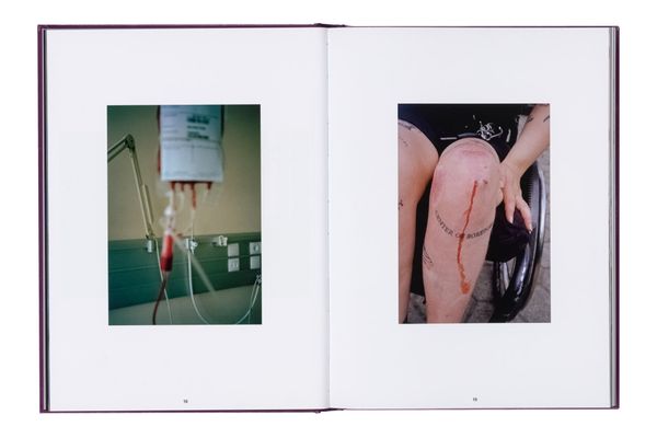 Image from a project on PhMuseum