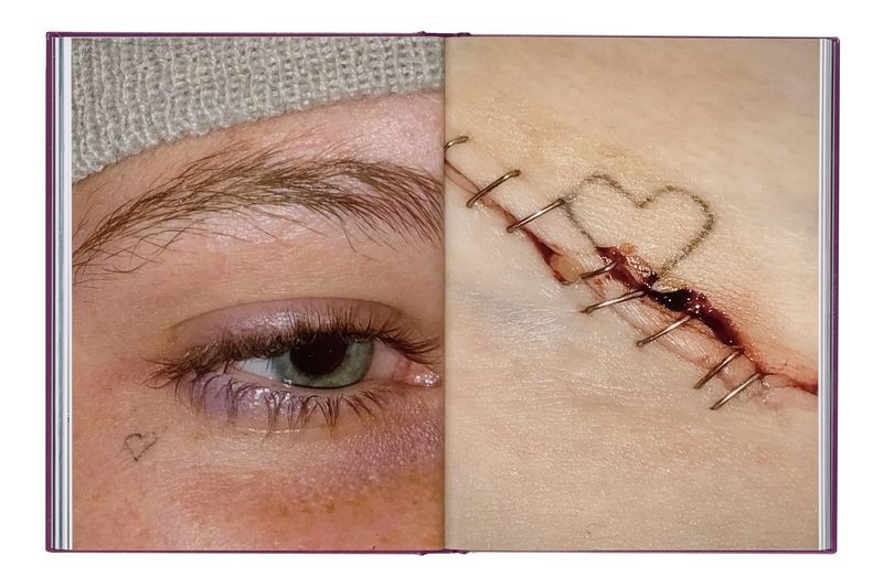 Image from a project on PhMuseum