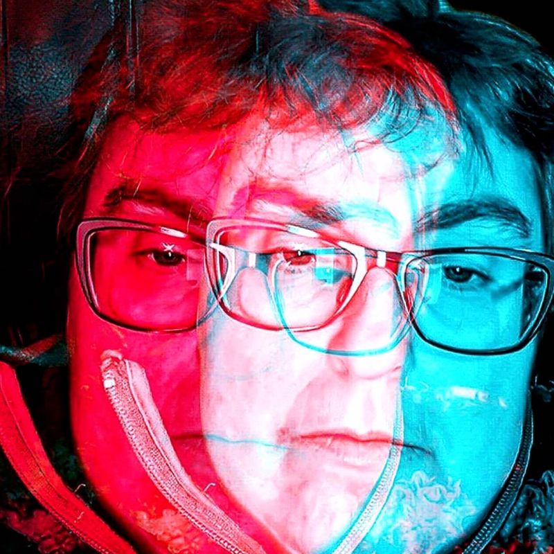 © JO SUTHERST - Image from the Addison's Disease - Behind the Smile photography project