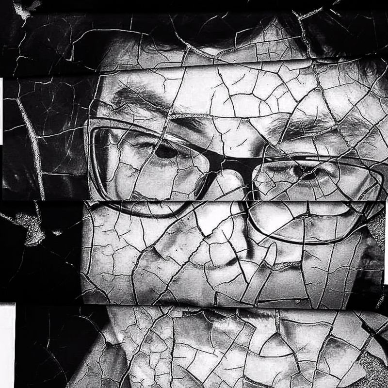 © JO SUTHERST - Image from the Addison's Disease - Behind the Smile photography project