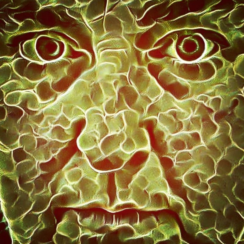 © JO SUTHERST - Image from the Addison's Disease - Behind the Smile photography project