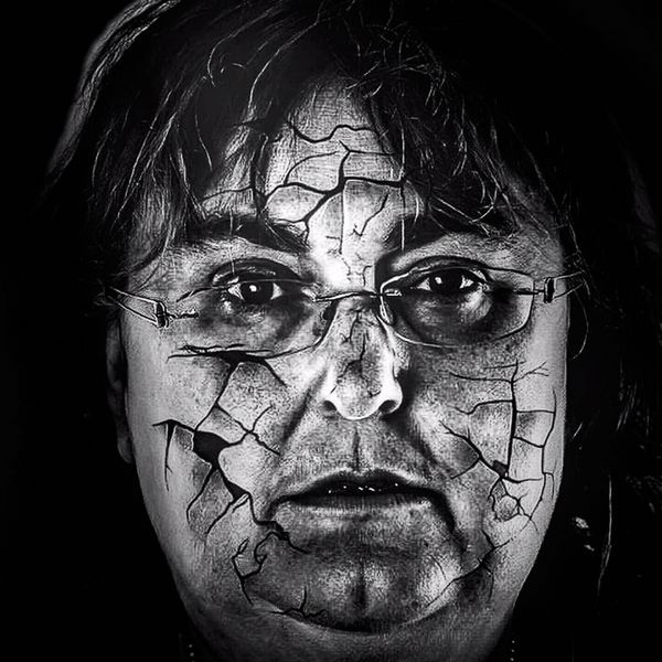 © JO SUTHERST - Image from the Addison's Disease - Behind the Smile photography project