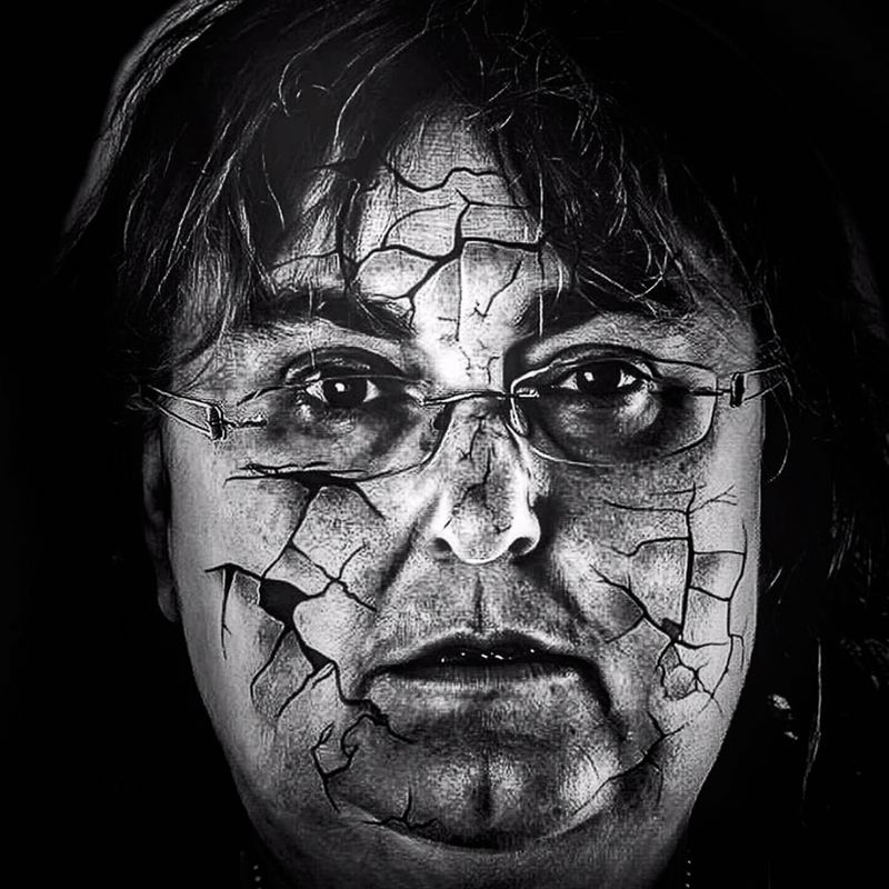 © JO SUTHERST - Image from the Addison's Disease - Behind the Smile photography project