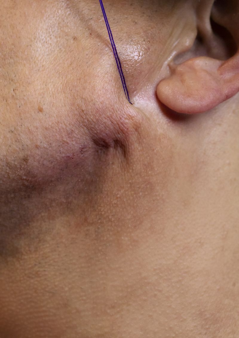 © Anne Morgenstern - Image from the Sunset Sour photography project