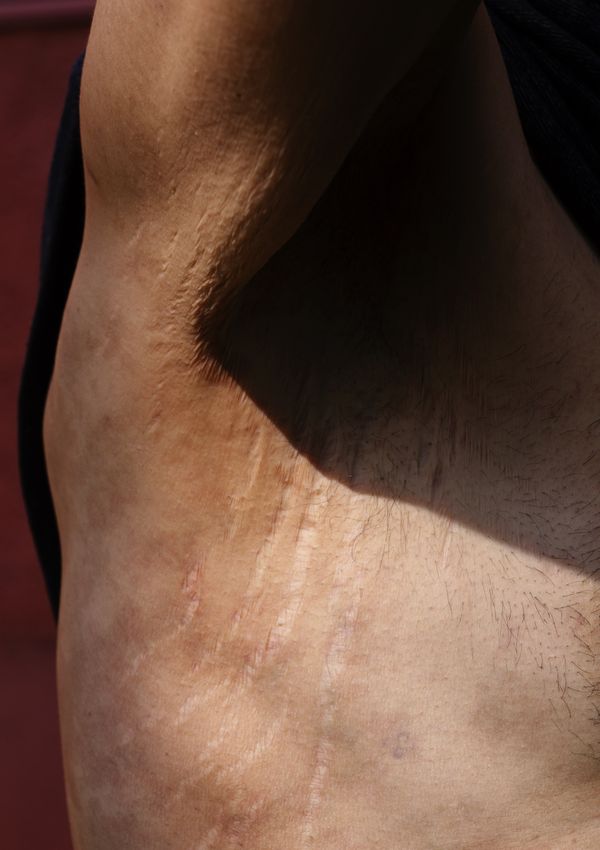 © Anne Morgenstern - Image from the Sunset Sour photography project