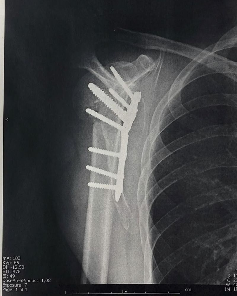 Image from a project on PhMuseum