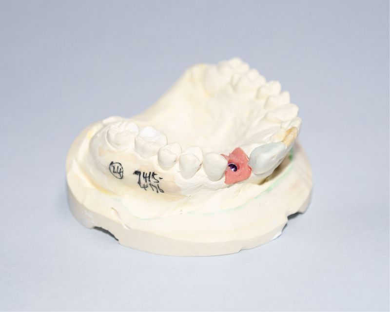 © Frederic Pels - Image from the Error in Ypsilon photography project