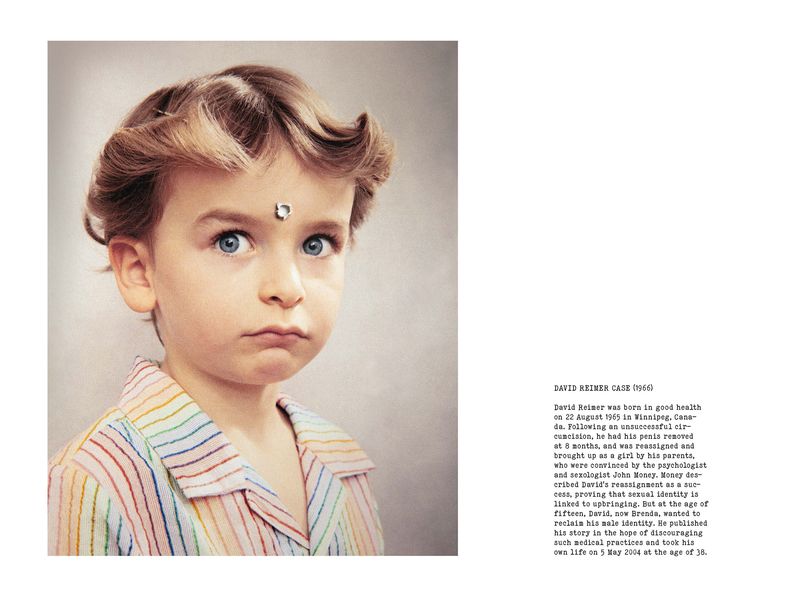 © Coco Amardeil - Image from the SHOCK THERAPY photography project