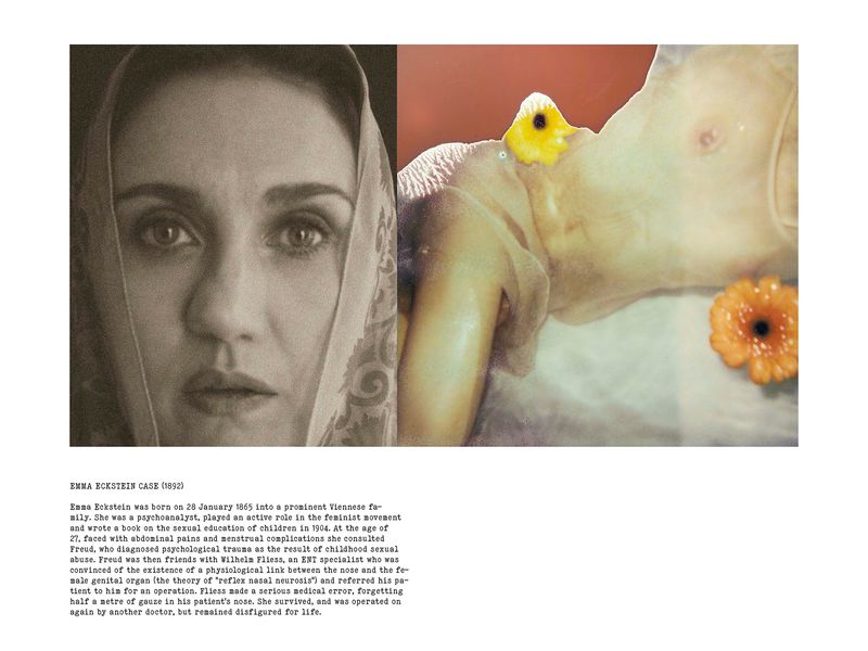 © Coco Amardeil - Image from the SHOCK THERAPY photography project