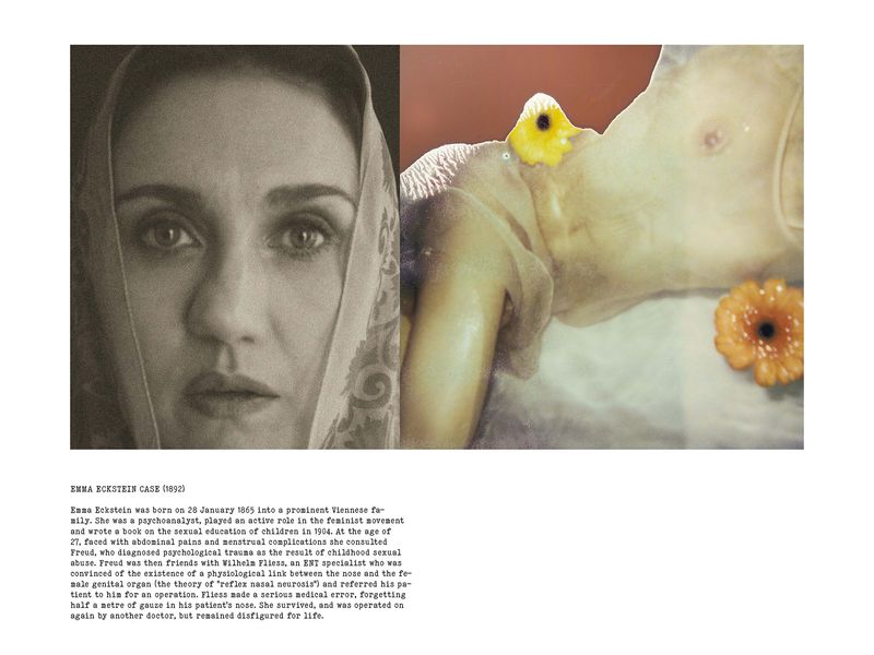 © Coco Amardeil - Image from the SHOCK THERAPY photography project