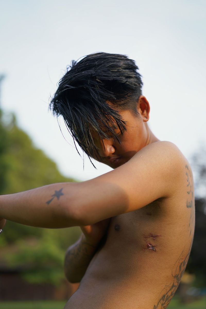 © Jade Thiraswas - Bullet wounds on Eh Moo Ku