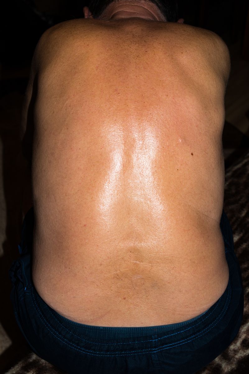 © Ela Polkowska - Image from the Firmly Pinch The Skin Together photography project