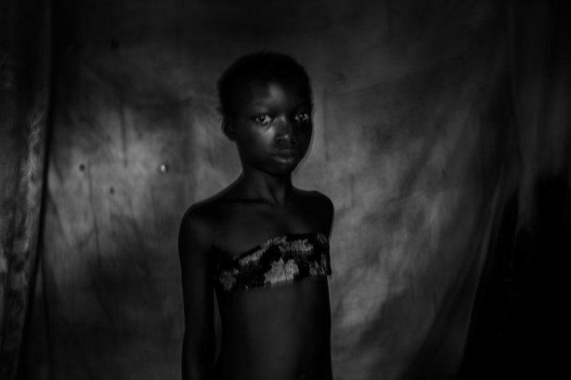 © Heba Khamis - Suzanne, 11 years old, experienced breast ironing couple of months before that image until her breast totally gone.