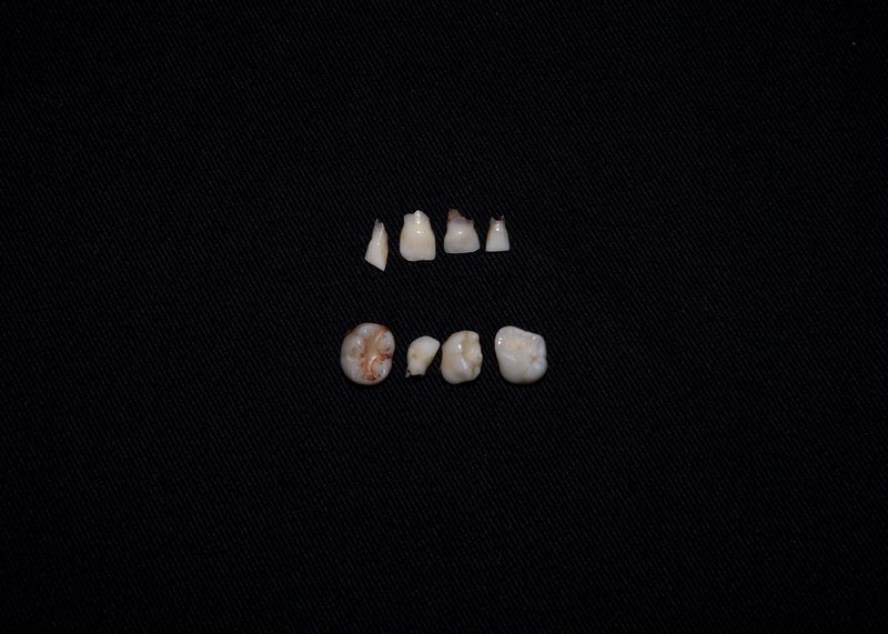 © Katie Murray - Teeth