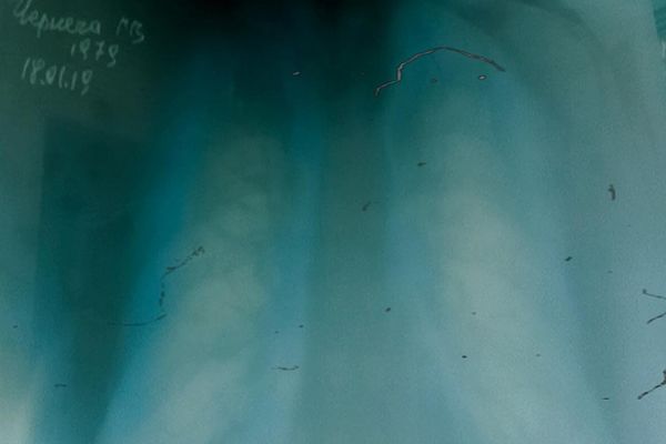 © Gennadiy Chernega - Image from the boomerang photography project