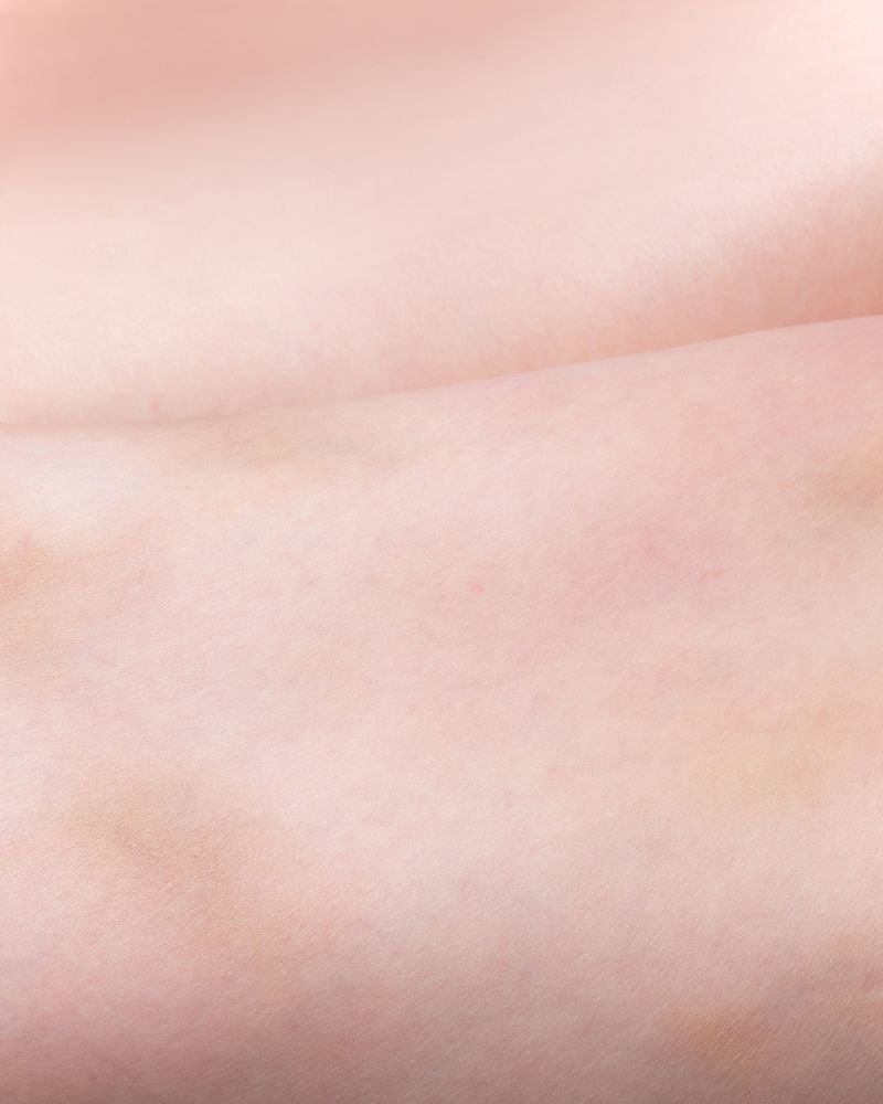 © Claire Sunho Lee - Bruise 1, 2021