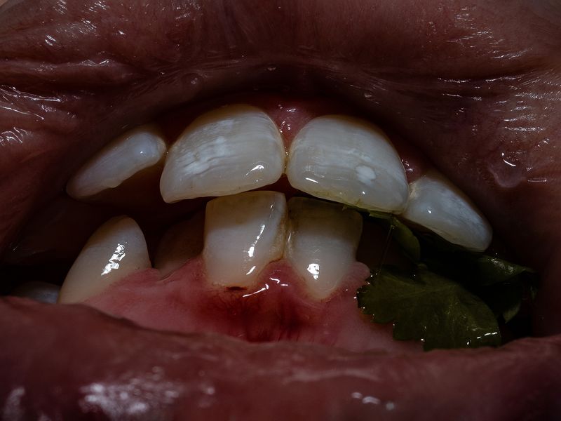 © Nika Sandler - Image from the Plant and Human Pain photography project