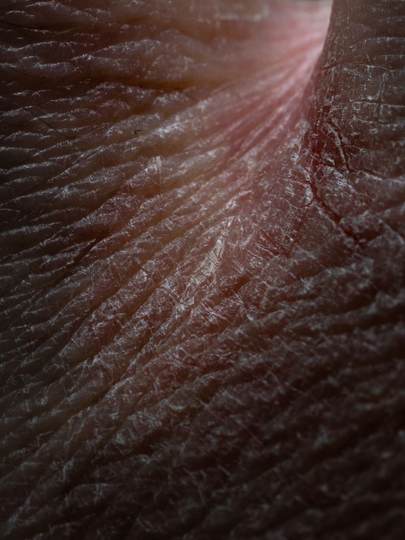 © Nika Sandler - Image from the Plant and Human Pain photography project