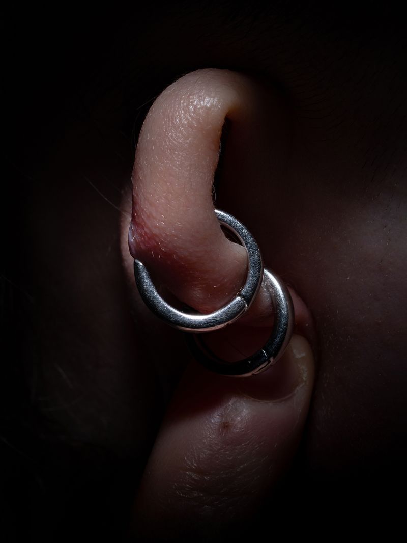 © Nika Sandler - Image from the Plant and Human Pain photography project