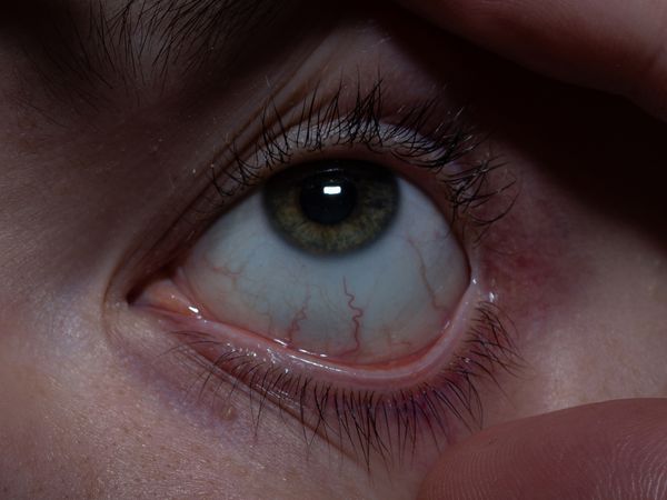 © Nika Sandler - Image from the Plant and Human Pain photography project