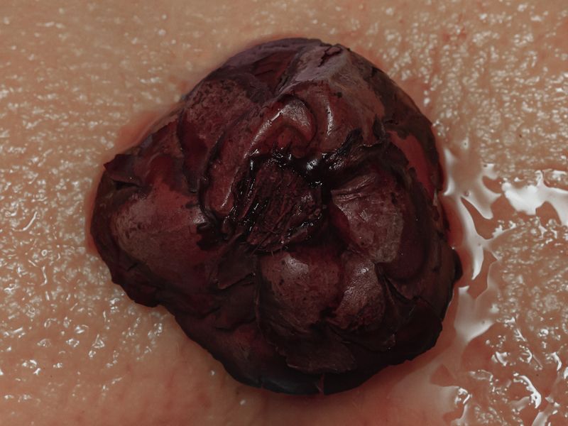 © Nika Sandler - Image from the Plant and Human Pain photography project