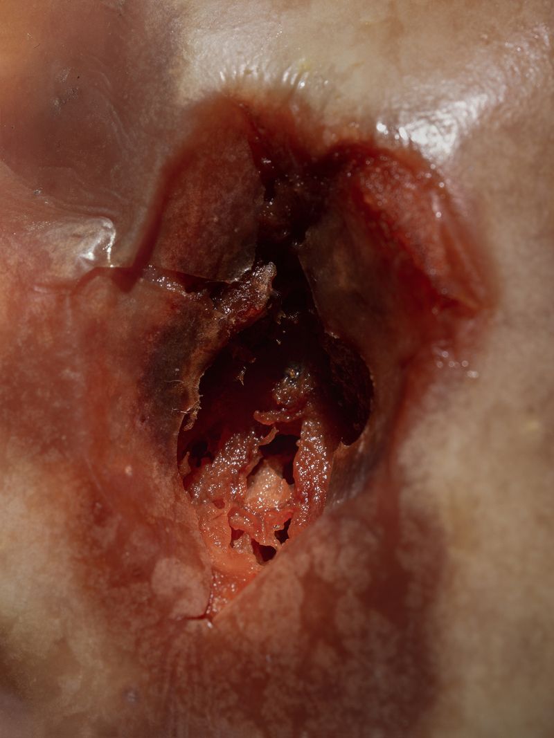 © Nika Sandler - Image from the Plant and Human Pain photography project