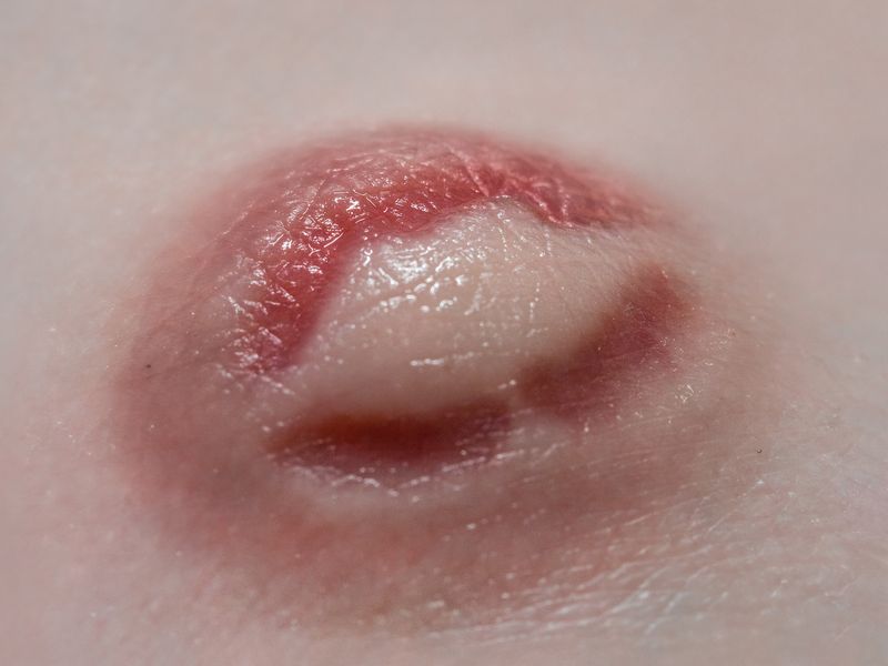 © Nika Sandler - Image from the A History of Teeth photography project