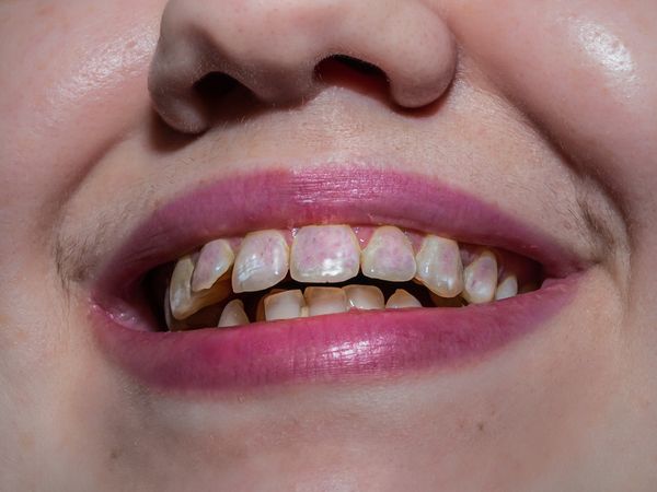 © Nika Sandler - Image from the A History of Teeth photography project