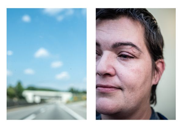 © Wil Sands - Image from the Shot in the Eye, Exploring Blinding by Police photography project