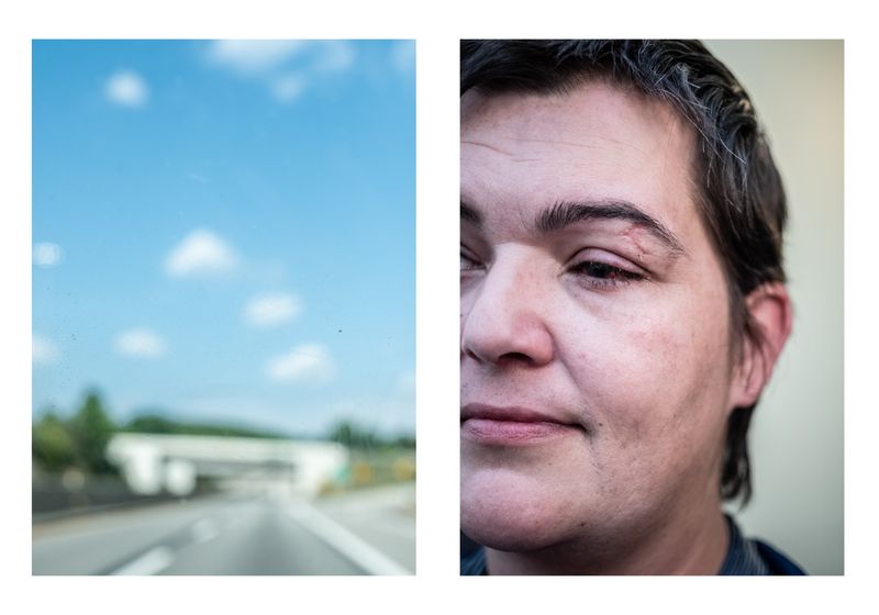 © Wil Sands - Image from the Shot in the Eye, Exploring Blinding by Police photography project