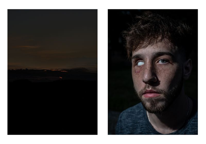 © Wil Sands - Image from the Shot in the Eye, Exploring Blinding by Police photography project