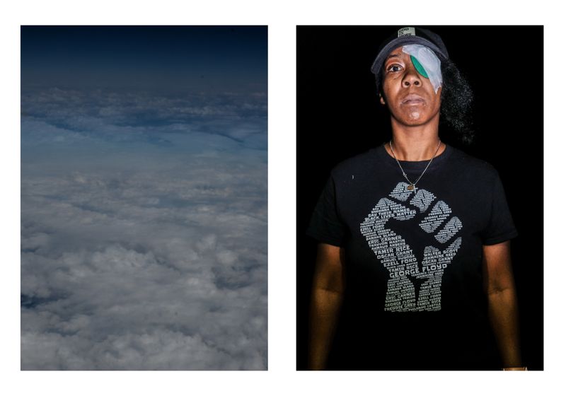 © Wil Sands - Image from the Shot in the Eye, Exploring Blinding by Police photography project