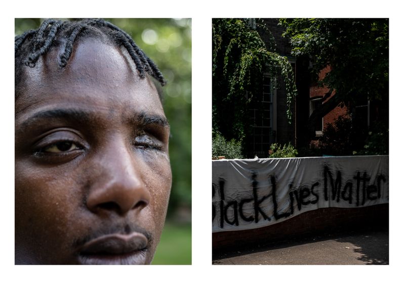 © Wil Sands - Image from the Shot in the Eye, Exploring Blinding by Police photography project