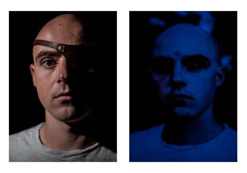 © Wil Sands - Image from the Shot in the Eye, Exploring Blinding by Police photography project