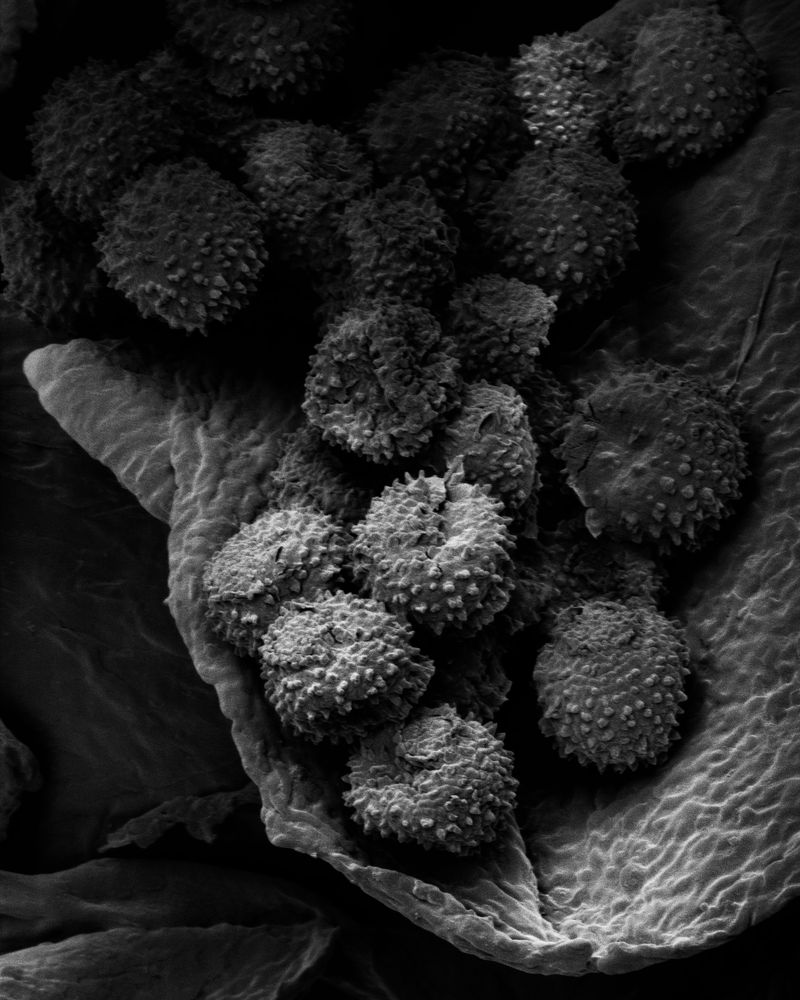 © Oliver Woods - An electron microscope image of pollen found in a dust sample from the top of a wardrobe.