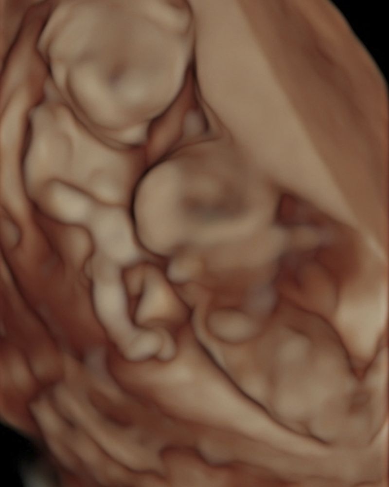 © Juliana Gómez Quijano - Image from the Las Dos Hebras (The Two Strands) photography project