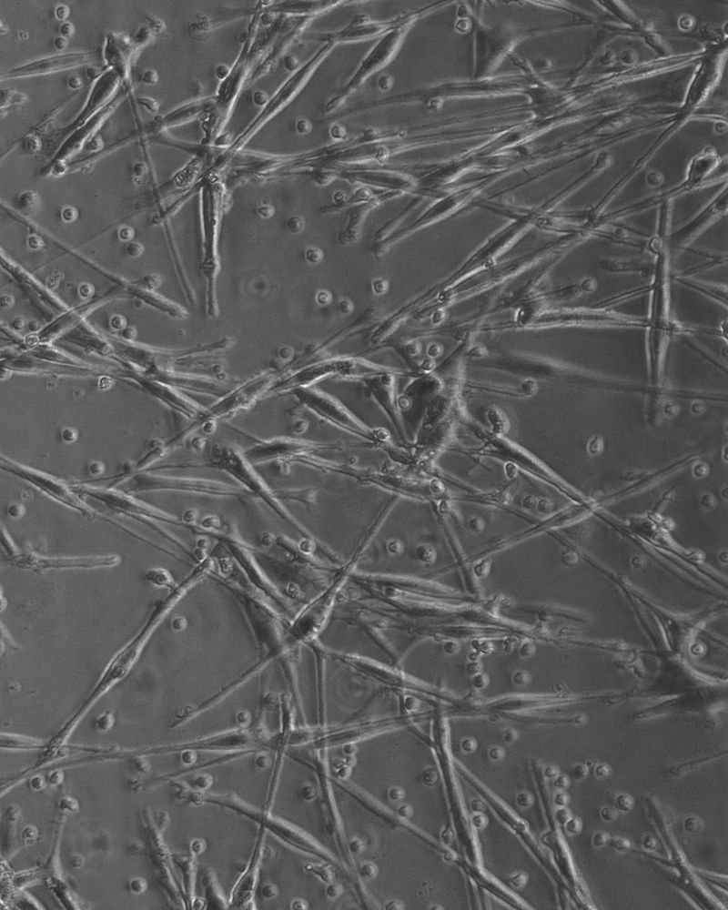 © Juliana Gómez Quijano - Blood cells from my sister Manuela surrounded by macrophages.