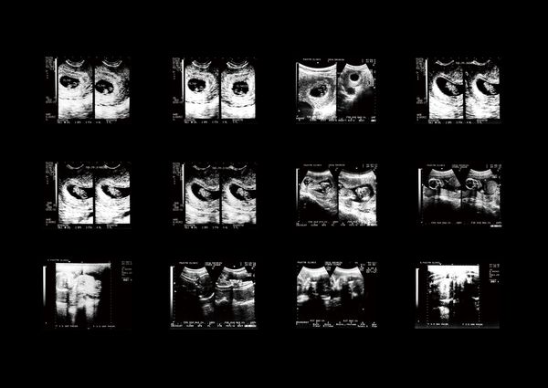 © Misaki Shimizu - Image from the Solipsism Syndrome photography project