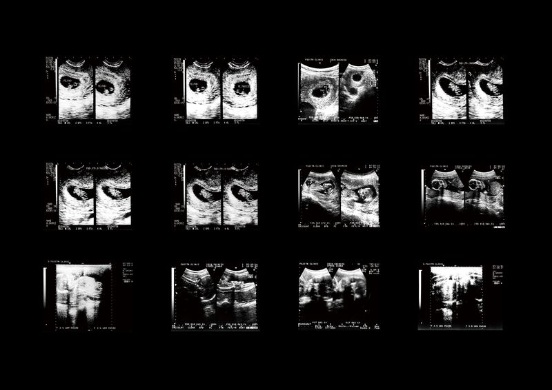 © Misaki Shimizu - Image from the Solipsism Syndrome photography project